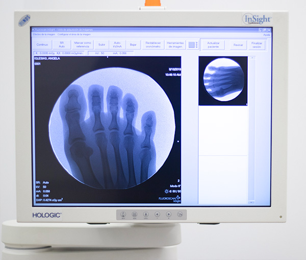 radiologia-diagnostica-del-pie-2