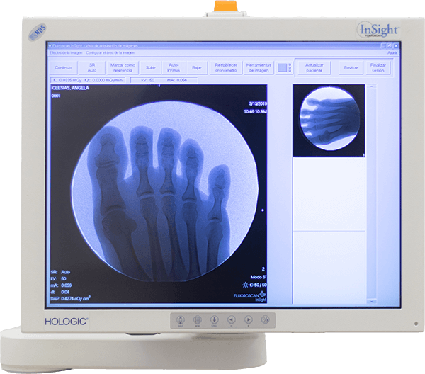 Monitor con rradiografía de pie